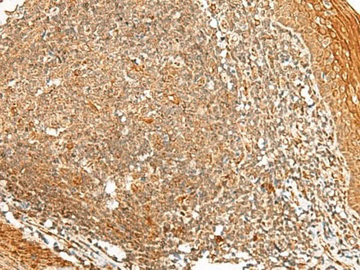 Immunohistochemistry of paraffin-embedded Human tonsil tissue using PPOX Polyclonal Antibody at dilution of 1:45(×200)