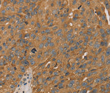 Anti-Human/Mouse PARP11 Antibody - ABMIUM