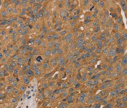 Anti-Human/Mouse PARP11 Antibody