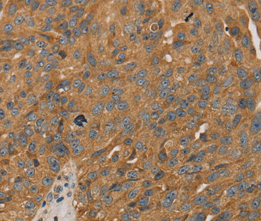Anti-Human/Mouse PARP11 Antibody - ABMIUM