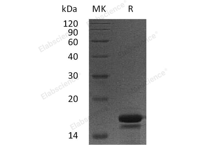 Recombinant Human PDCD5/TFAR19 Protein (His Tag) - ABMIUM