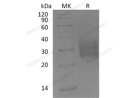 Recombinant Mouse TGFBR2 Protein (His Tag) - ABMIUM