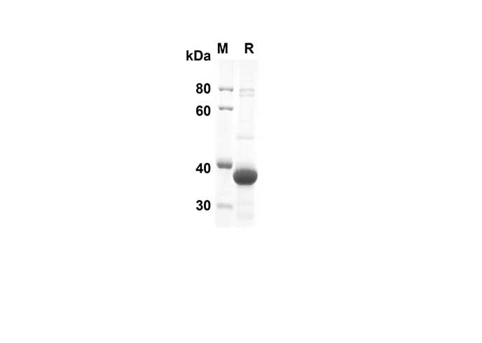 SDS-PAGE analysis of Human FGF4 proteins, 2 μg/lane of Recombinant Human FGF4 proteins was resolved with SDS-PAGE under reducing conditions, showing bands at 39.2 kDa.