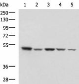 Western blot analysis of HepG2 NIH/3T3 C2CL2 Raji and Jurkat cell lysates using ENO3 Polyclonal Antibody at dilution of 1:1000