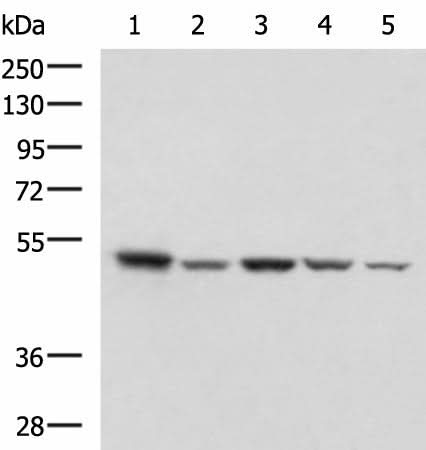 Western blot analysis of HepG2 NIH/3T3 C2CL2 Raji and Jurkat cell lysates using ENO3 Polyclonal Antibody at dilution of 1:1000