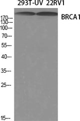 Western Blot analysis of 293T-UV, 22RV1 cells using BRCA1 Polyclonal Antibody at dilution of 1:1000.