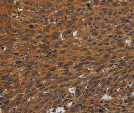 Anti-Human PNOC Antibody