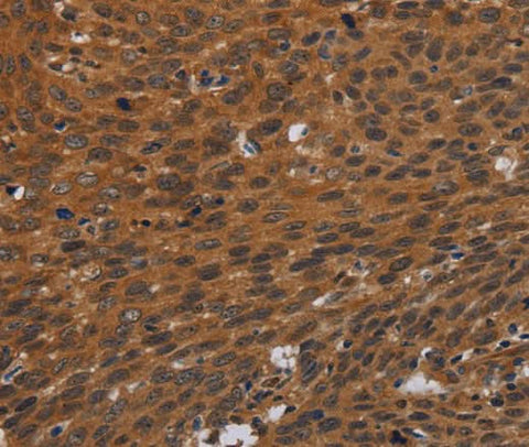 Anti-Human PNOC Antibody - ABMIUM