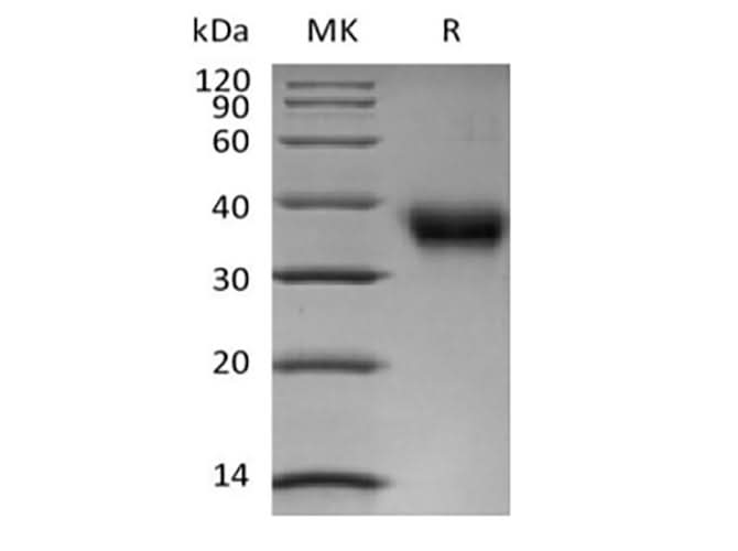 Recombinant Human Folate Receptor alpha/FOLR1 (C-6His-Avi) Biotinylated - ABMIUM