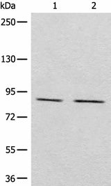Anti-Human/Mouse/Rat MARK2 Antibody - ABMIUM