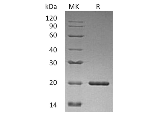 Recombinant Human Sonic Hedgehog/SHH Protein - ABMIUM