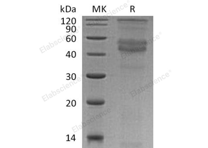 Recombinant Human CD79B/B29 Protein (His Tag) - ABMIUM