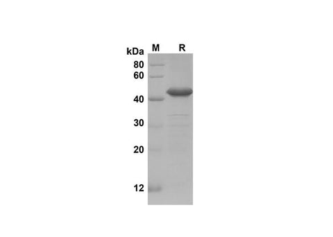 SDS-PAGE analysis of Mouse IGFBP-1 proteins, 2 μg/lane of Recombinant Mouse IGFBP-1 proteins was resolved with SDS-PAGE under reducing conditions, showing bands at 42 kDa.