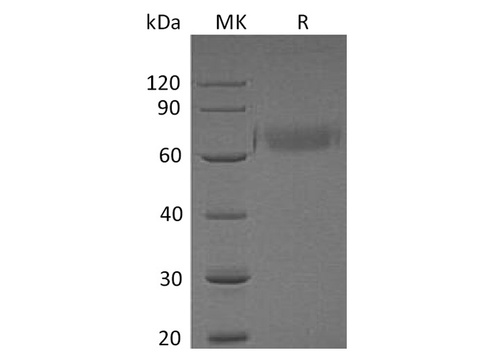 Recombinant Human ORP150/HSP12A Protein (His Tag) - ABMIUM