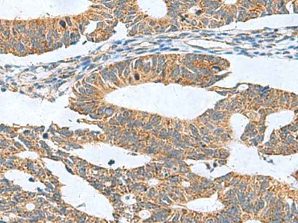 Anti-Human CLEC1B Antibody