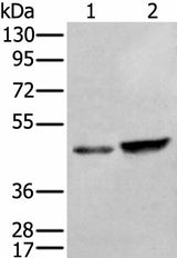 Western blot analysis of HUVEC and Hela cell lysates using ZNF24 Polyclonal Antibody at dilution of 1:350