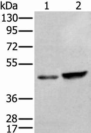 Anti-Human/Mouse/Rat ZNF24 Antibody