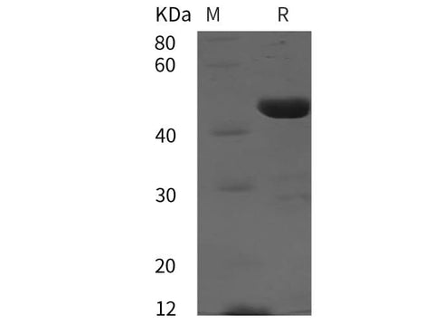 SDS-PAGE analysis of Human PAI-2 proteins, 2 μg/lane of Recombinant Human PAI-2 proteins was resolved with SDS-PAGE under reducing conditions, showing bands at 45 kDa.