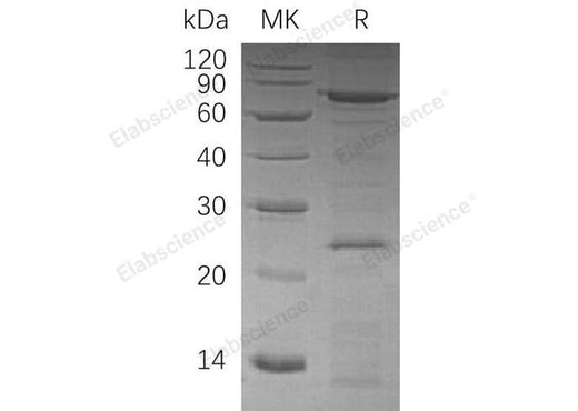 Recombinant Human VCP Protein (His Tag) - ABMIUM