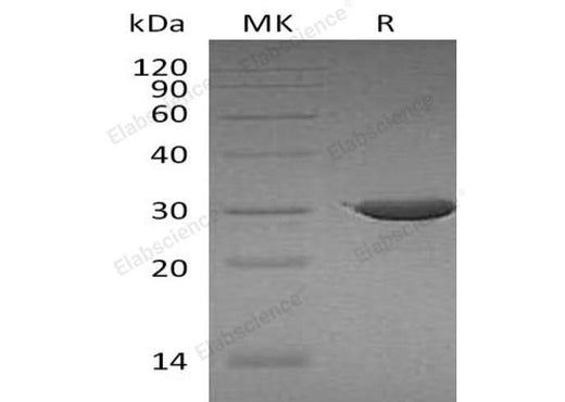 Recombinant Human ABCB5 Protein (Trx Tag) - ABMIUM
