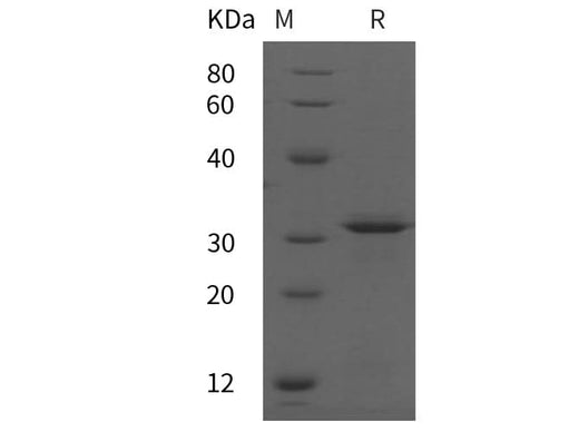 SDS-PAGE analysis of Human AQP-3 proteins, 2 μg/lane of Recombinant Human AQP-3 proteins was resolved with SDS-PAGE under reducing conditions, showing bands at 37 kDa.