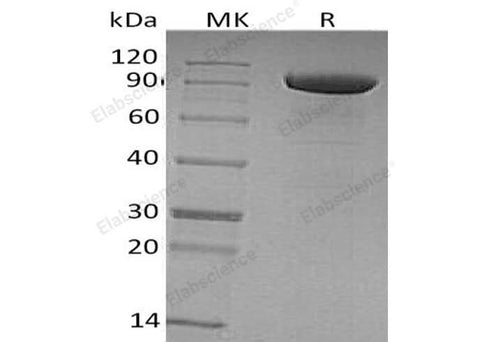 Recombinant Human Tie1 Protein (His Tag) - ABMIUM