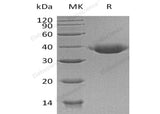 Recombinant Human JAM-B/CD322 Protein (His Tag) - ABMIUM