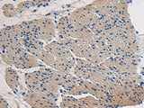 Anti-Human/Mouse COL17A1 Antibody - ABMIUM
