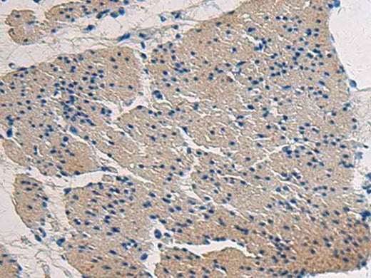 Anti-Human/Mouse COL17A1 Antibody