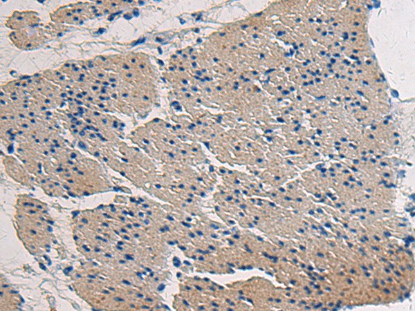 Anti-Human/Mouse COL17A1 Antibody - ABMIUM