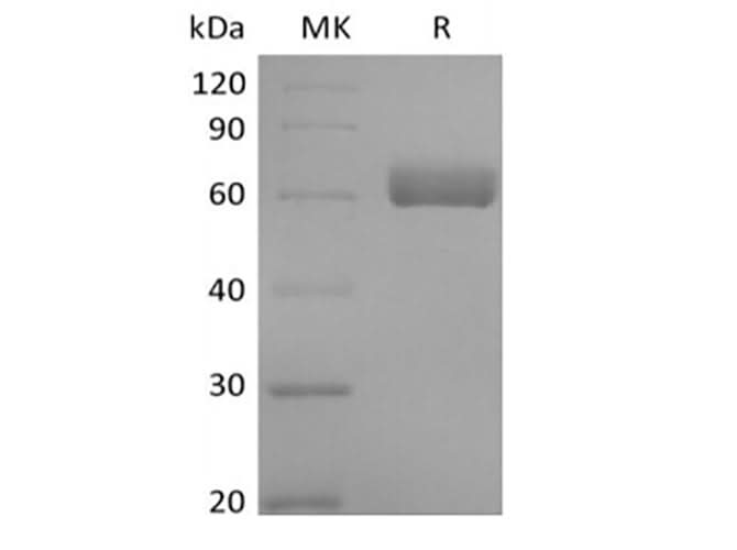 Recombinant Human Butyrophilin-like Protein 9/BTNL9 (C-Fc) - ABMIUM