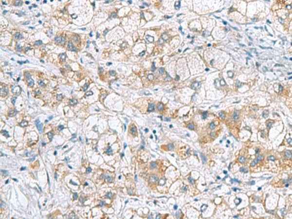 Anti-Human/Mouse/Rat GCSH Antibody