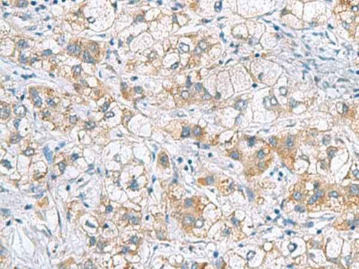 Anti-Human/Mouse/Rat GCSH Antibody
