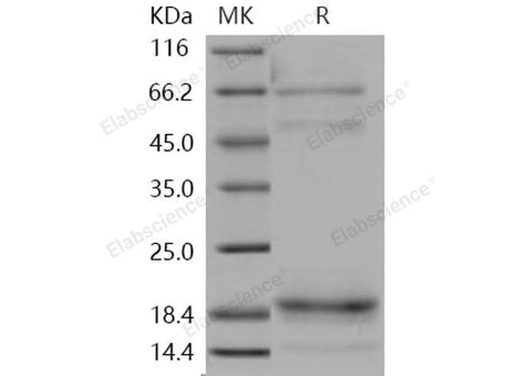 Recombinant Human Cochlin/COCH Protein (His Tag) - ABMIUM