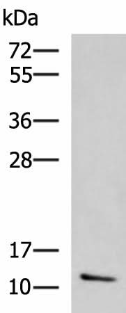 Western blot analysis of Human ileum tissue lysate using CCL13 Polyclonal Antibody at dilution of 1:800