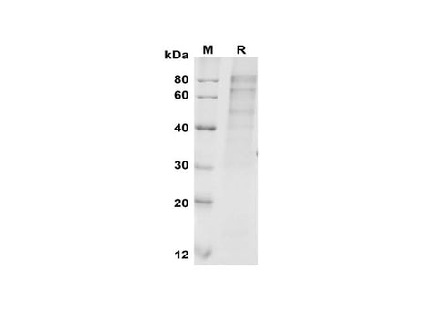 SDS-PAGE analysis of Human FURIN proteins, 2 μg/lane of Recombinant Human FURIN proteins was resolved with SDS-PAGE under reducing conditions, showing bands at 80-90 kDa.