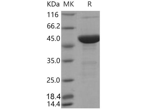 Recombinant Mouse S100A15/S100A7A Protein (His & MBP Tag) - ABMIUM