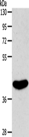 Anti-Human/Mouse EDG6 Antibody - ABMIUM