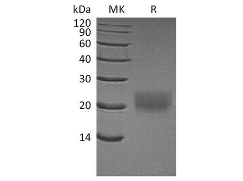 Recombinant Human CTLA4 Protein (His Tag) - ABMIUM