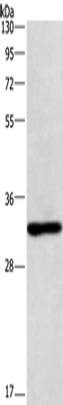 Anti-Human/Mouse NAPSA Antibody - ABMIUM