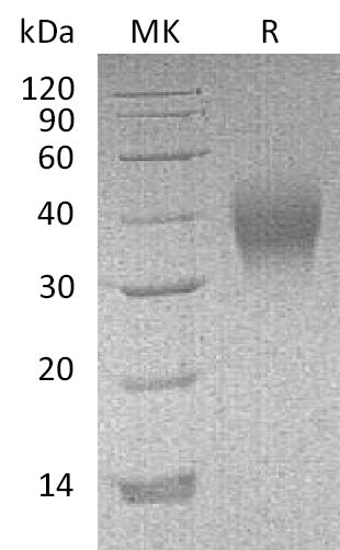 Recombinant Mouse CD16/FCGR3 Protein (His Tag) - ABMIUM