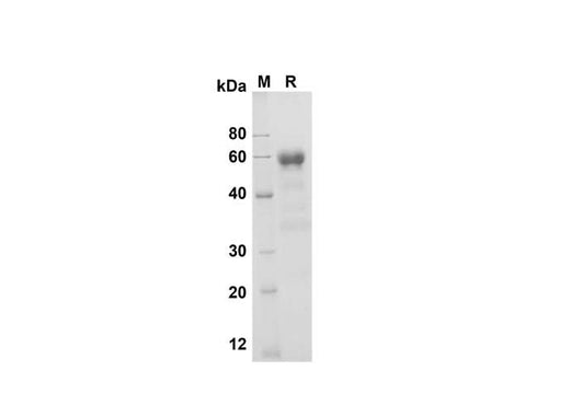 SDS-PAGE analysis of Mouse CD27/TNFRSF7 proteins , 2 μg/lane of Recombinant Mouse CD27/TNFRSF7 proteins was resolved with SDS-PAGE under reducing conditions , showing bands at 60 kDa.