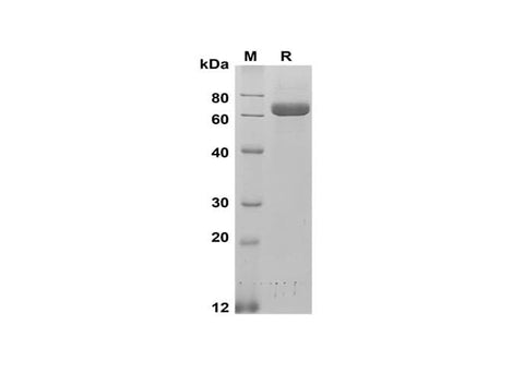 SDS-PAGE analysis of Human ALPP proteins, 2 μg/lane of Recombinant Human ALPP proteins was resolved with SDS-PAGE under reducing conditions, showing bands at 60-70 kDa.