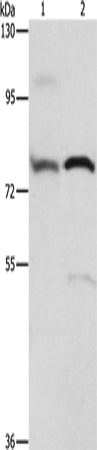 Anti-Human/Mouse/Rat ATXN1 Antibody - ABMIUM