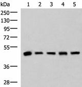 Western blot analysis of Human fetal liver tissue HepG2 A172 Hela and Jurkat cell lysates using PCYT2 Polyclonal Antibody at dilution of 1:800