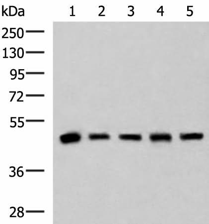 Western blot analysis of Human fetal liver tissue HepG2 A172 Hela and Jurkat cell lysates using PCYT2 Polyclonal Antibody at dilution of 1:800
