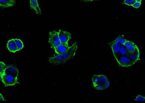 Anti-Human CDH1 Antibody [A1133] - ABMIUM