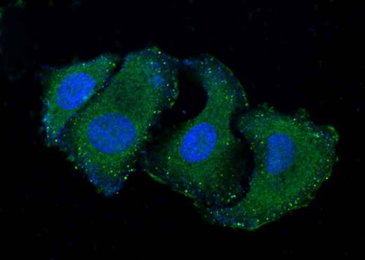Anti-Human RELT Antibody [A1031] - ABMIUM