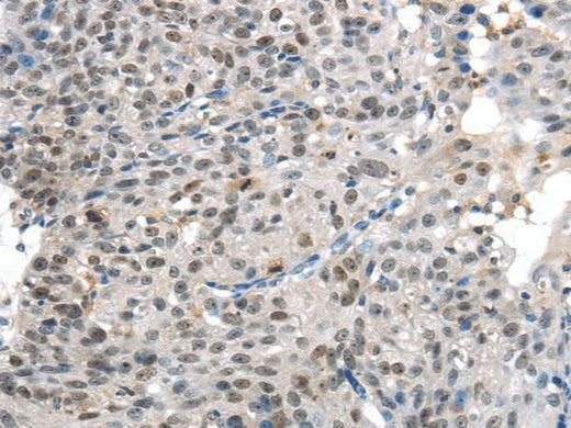 Anti-Human KDM5C Antibody - ABMIUM