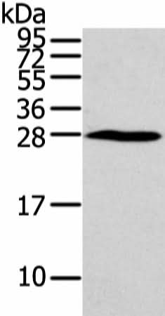 Anti-Human/Mouse HOXC6 Antibody - ABMIUM